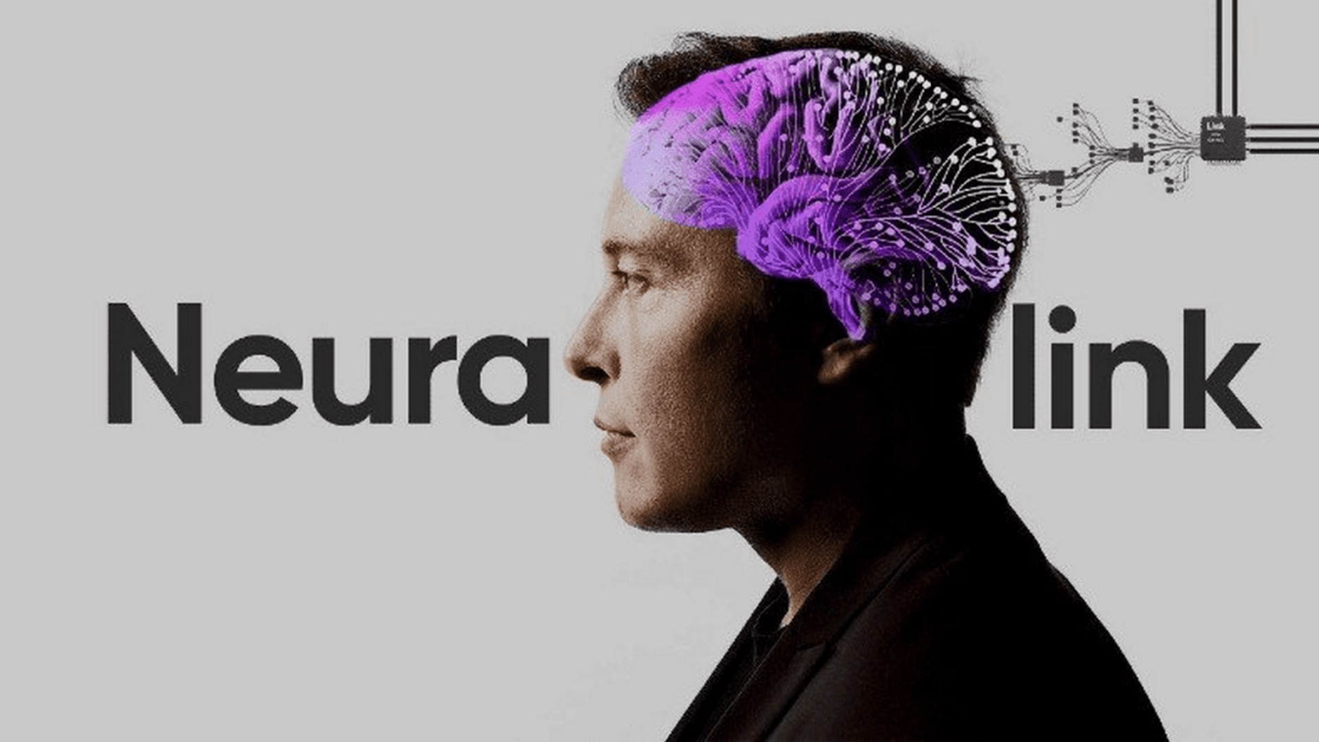Implante Cerebral Inovador da Neuralink Promete Revolucionar a Interação com a Tecnologia